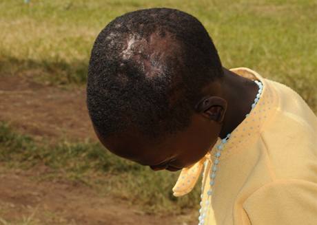 Jedenctiletou masajskou holiku Risianu Lepalo mltil jej manel tupm pedmtem do hlavy. Pak utekla.