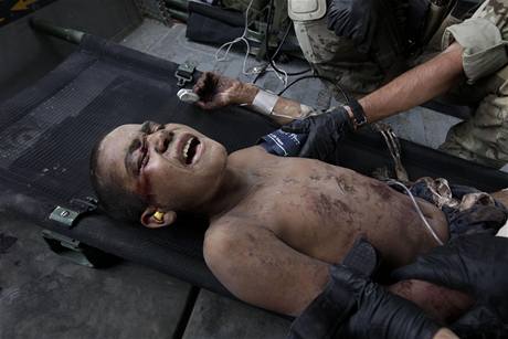 Amerit zchrani pepravuj afghnskho chlapce, kter lpl na minu, do nemocnice