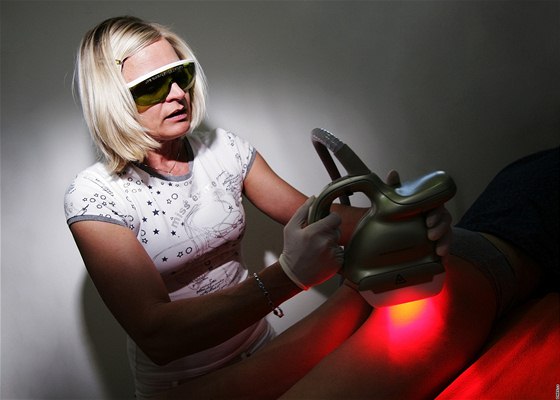 Certifikovaný laser SmoothShapes - je uren pro odstranní celulitidy a vyhlazení ke