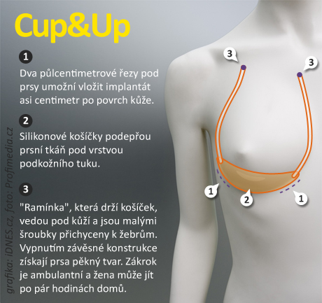 infografika - Plastika Cup and Up