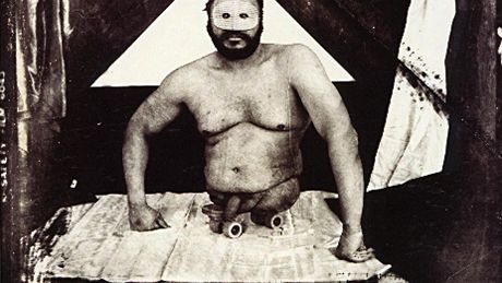 Joel Peter Witkin - Man Without Legs (1984)