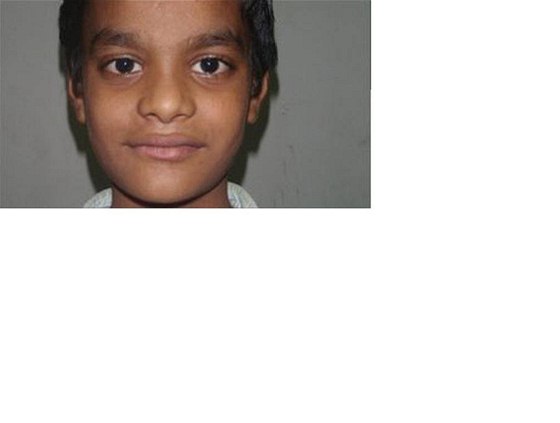 Malý indický chlapec strávil tyi msíce daleko od rodiny (12. záí 2010)