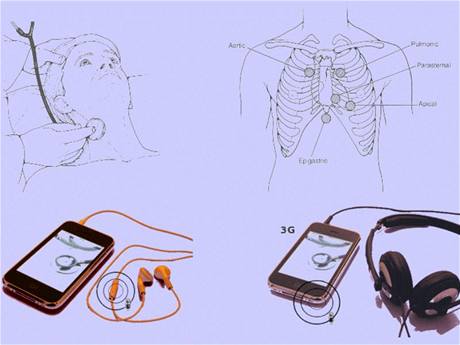 Aplikace iSthetoscope