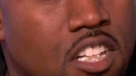 Kanye West má místo zub diamanty