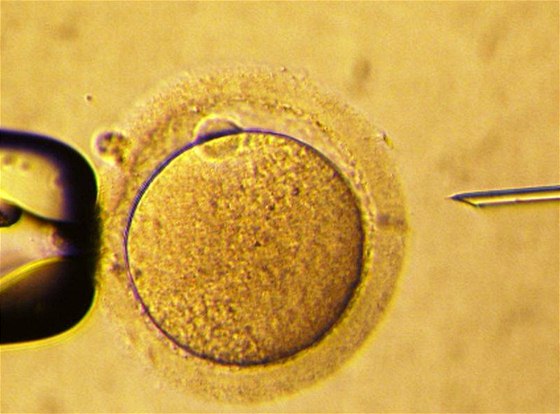 Zavedení spermie do vajíka - snímek ze speciálního mikroskopu atomových sil