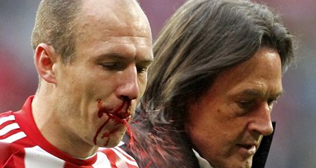 ZRANN HVZDA. Arjen Robben z Bayernu sice vstelil v zpase s Hoffenheimem dva gly, ale musel se vypodat i s krvavm zrannm v oblieji.