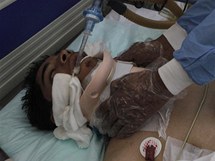Lka oetuje jednu z obt nsilnost v Libyi (24. nora 2011)