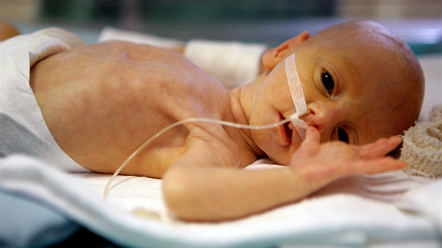Amillia Taylorová se narodila ve 22. týdnu thotenství a váila pouhých 284 gram, pesto ji lékai zachránili
