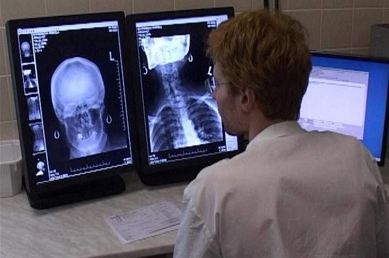 V pardubické nemocnici posílají rentgenové snímky po síti. Ilustraní foto. 