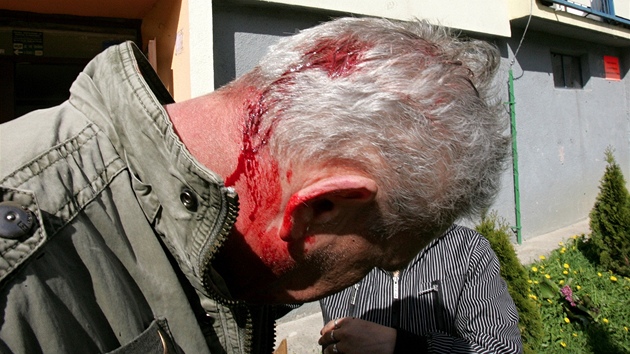 Mu zranní pi potyce demonstrant s policií v Krupce (9. dubna 2011)