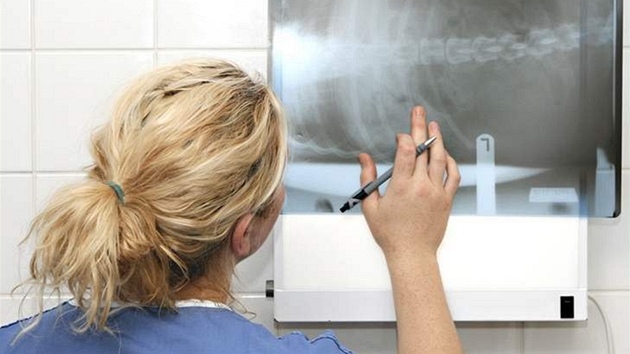 Nádor je vtinou objeven na rentgenogramu.