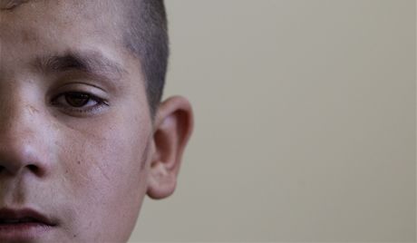 Afghnsk chlapec Fazel Rahmn v kbulsk polepovn pro mal sebevraedn atenttnky (14. kvtna 2011)