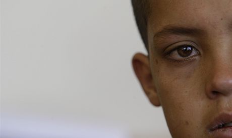 Afghnsk chlapec Mohamad Juns v kbulsk polepovn pro mal sebevraedn atenttnky (14. kvtna 2011)