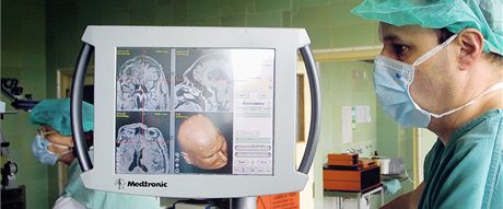 Záchranái vozí od ledna do nemocnice v Trutnov lidi po mrtvici z dalích dvou region. Iktové centrum (ilustraní snímek).