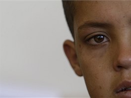 Afghnsk chlapec Mohamad Juns v kbulsk polepovn pro mal sebevraedn atenttnky (14. kvtna 2011)