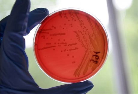 Enterohemoragická Escherichia coli (EHEC) v misce pracovníka hygienické stanice v Hamburku (23. kvtna 2011)