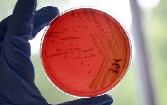 Enterohemoragická Escherichia coli (EHEC) v misce pracovníka hygienické stanice v Hamburku (23. kvtna 2011)