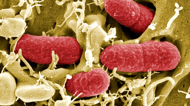 Bakterie Enterohemoragické Escherichie coli (EHEC) Bakterie Enterohemoragické Escherichie coli (EHEC)