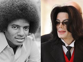 Michael Jackson ped a po plastické operaci
