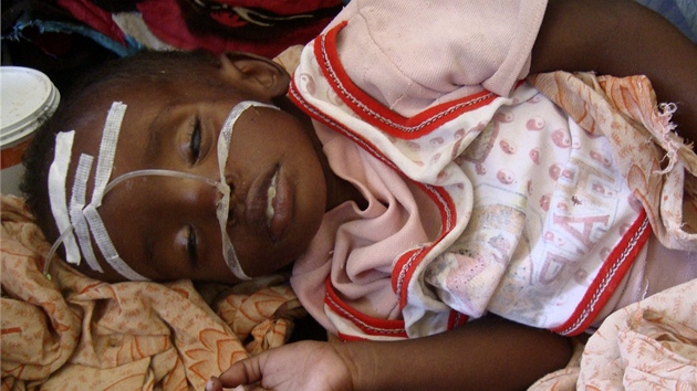 Hladomor v Somálsku ohrouje miliony lidí, pomoc potebuje polovina obvyatel