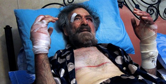 Zbitý karikaturista Alí Farzat v damaské nemocnici (25. srpna 2011)