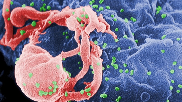 Virus HIV (zeleně) na bílé krvince Virus HIV (zeleně) na bílé krvince