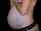Krásná thotná - Linda Matejovie, 32. týden thotenství