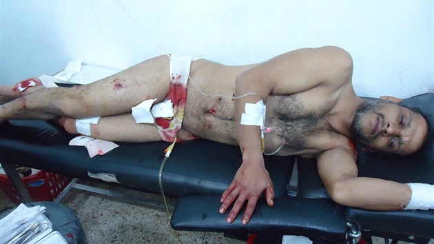 Mu zranný bhem ostelování syrského msta Homs (20. prosince 2011)