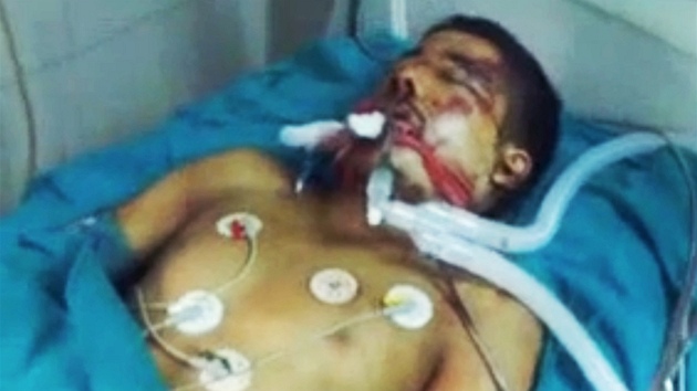 Zábr z amaterského videa ukazuje tce ranného mue v nemocnici v Homsu.