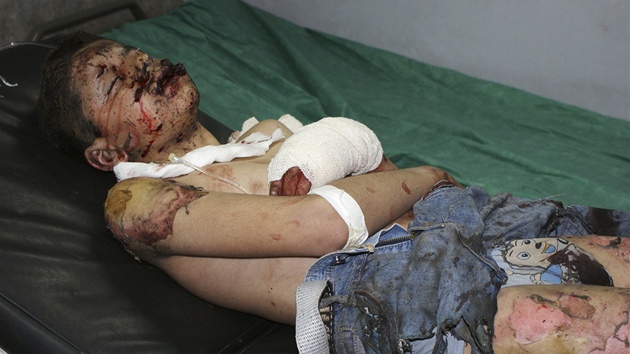 Chlapec zranný bhem vlny atentát v Bagdádu (23. února 2012)