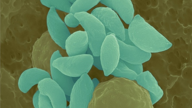 Pod mikroskopem vypadá Toxoplasma gondii jako malé rohlíky. 
