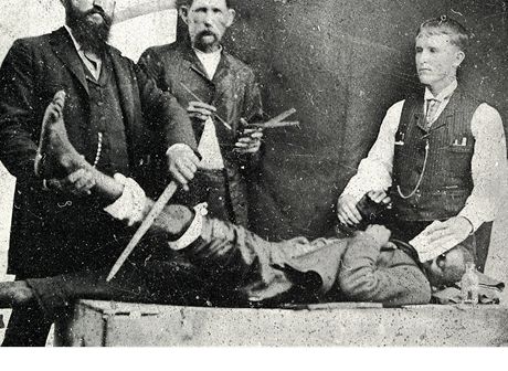 Fotografie nejspíe poízená mezi roky 1855 a 1860 zobrazuje doktora Longa pi (jen inscenované) operaci s pouitím éteru. Krom roku poízení nevíme pesn ani to, kdo z mu na fotografii je Crawford Long.