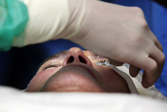 Lékai ve Valaském oním centru vyzkoueli unikátní operaci oí. (Ilustraní snímek)