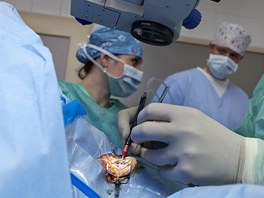V Praze se uskutenila první laserová operace edého zákalu bez skalpelu v...