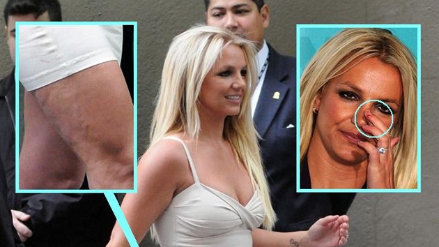 Britney Spears pedvedla celulitidu a zniené nehty.