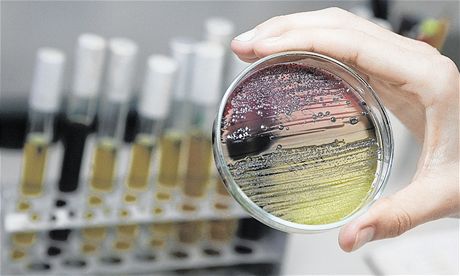Výsledky laboratorních test, zjiujících výskyt bakterií v eskobudjovickém výmníku, budou známy a za nkolik dní. (Ilustraní foto)