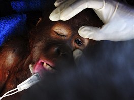 Indonétí veterinái zachraují orangutana Anyin, který kvli patné péi svého...