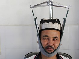 MUENÍ? NE. MEDICÍNA. Etnický Ujgur bhem tradiní ínské léby osteoartrózy...