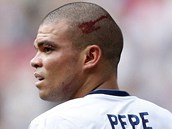 ZRANN Portugalsk stoper Pepe z Realu Madrid po srce s vlastnm brankem