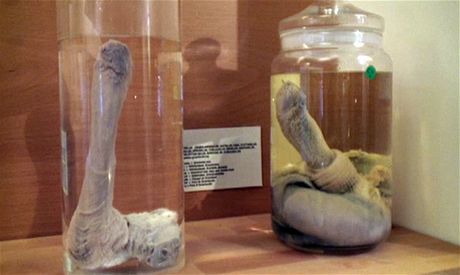 Muzeum penis