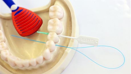 Bez dentální nit nám vypadávají zuby,stují si vzni. Ilustraní foto