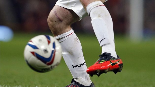 NEPKN JIZVA. Na prav noze ji m Wayne Rooney z Manchesteru United, jemu toto zrann zpsobil protihr kolkem kopaky.