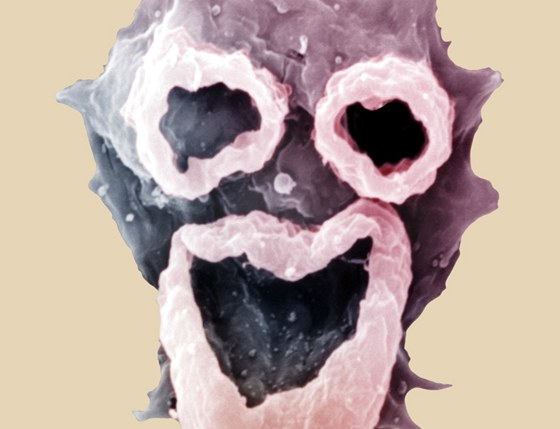 Parazit Naegleria fowleri zpsobuje chorobu zvanou primární amébová