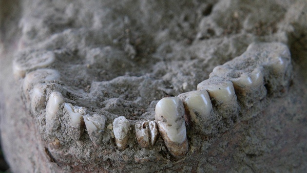V Majetn na Olomoucku odkryli archeologov u boch muk hroby vojk zejm z bitvy u Slavkova. Detail obrouench zub jednoho z vojk, jeho pinou bylo roztrhvn voskovanch obal nboj.