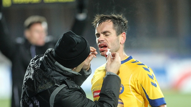 Jihlavsk fotbalista Tom Josl si musel po ostrm souboji nechat oetit krvav rm.