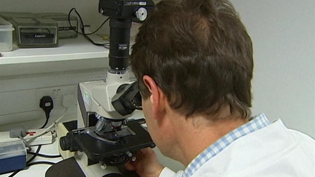 Vdci z cambridgesk univerzity ve spoluprci s veterini odebrali jezevkovi ichov buky. 