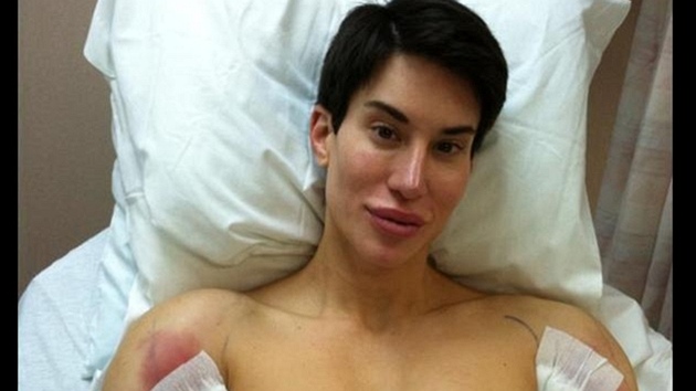 Justin Jedlica po jedn ze svch operac