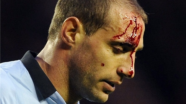 KREV VE TVI. Pablo Zabaleta z Manchesteru City odnesl jeden ze souboj krvavm zrannm.