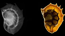 Semeno vience. Vlevo je rentgen, vpravo mikrofotografie. 