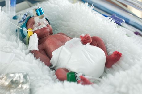 Perinatologická centra se starají o dti, které se narodí po 31. týdnu thotenství. (Ilustraní foto)